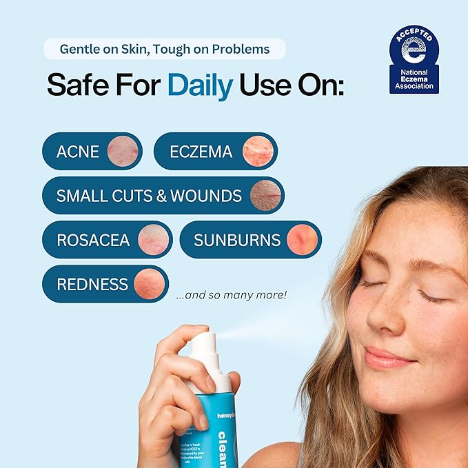 Hypochlorous Acid Spray – Dermatologist Tested HOCl Facial Cleanser for Sensitive, Acne-Prone & Irritated Skin Soothes Redness, Eczema, Rashes & Itching – Skin Repair Spray, 2oz + 6.8oz, Honeydew Labs