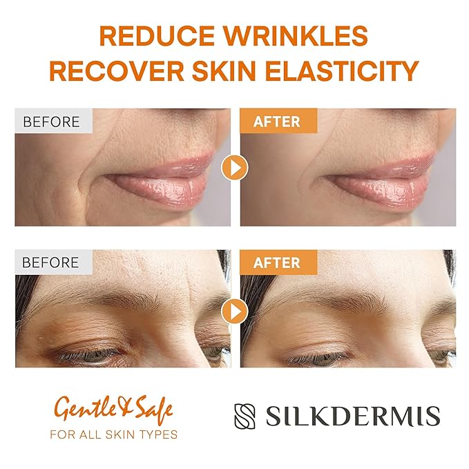 Forehead Wrinkle Patches with Triangle: For Smile Line and Under Eye-Anti Wrinkle Patches with Aloe, Collagen, Vitamin E 112pcs