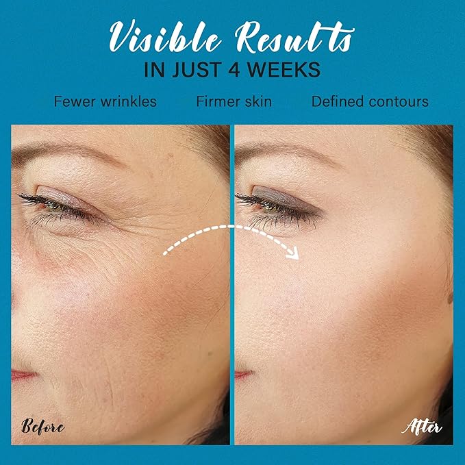 Tighten and Lift Neck Cream: Instant Face Lift Cream - 6-in-1 Anti-Aging Face Moisturizer for Anti-Wrinkle Firm - Collagen Retinol Peptides & Hyaluronic Acid Neck Firming Cream for Skin Care