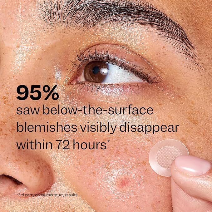 Peach Slices - Deep Blemish Microdarts (9 ct) - Early Stage Pimple Patches for Face - Salicylic Acid, Niacinamide, Hyaluronic Acid, Tea Tree Oil & Cica - Vegan, Cruelty Free, Korean Skin Care & Beauty | Salicylic Acid, Tea Tree Oil, Niacinamide, Cica, ...