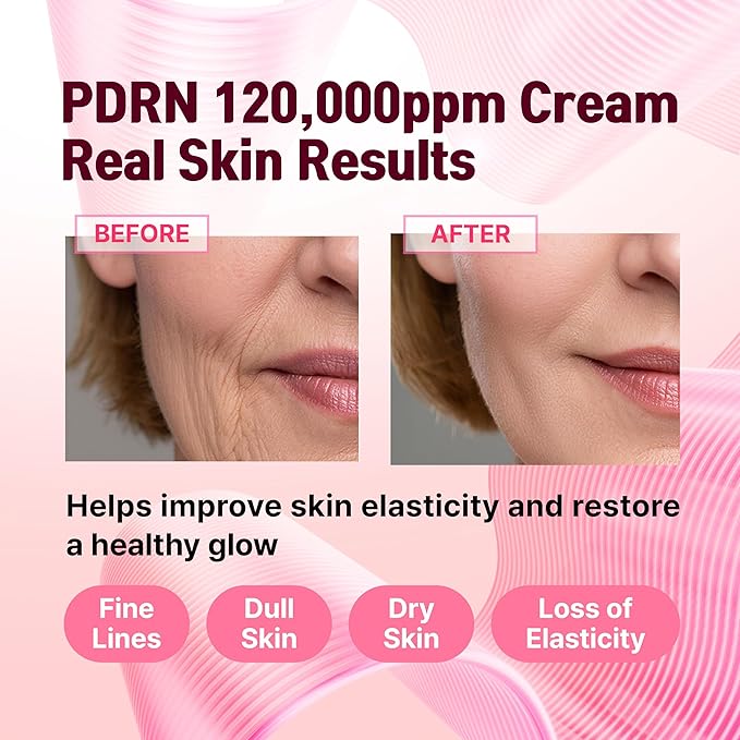 PDRN 120,000 ppm EGF Peptide Cream – Volufiline & Salmon DNA + 12% Phyto PDRN – Post Microneedling Aftercare Anti-Aging Face Cream w/Niacinamide & Hyaluronic Acid 1.7 oz