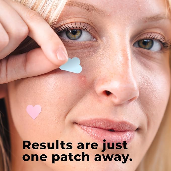 Pimple Patches for Face Cute (Hearts, Clouds Pink and Blue), Zit Patches Star Sticker 240 pack