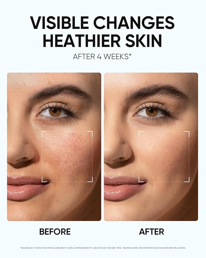 Face Moisturizer with 5X Ceramides, Hydrating Moisture Barrier Repair Cream for Sensitive/Oil Skin Types, Hyaluronic Acid & Centella, Daily Facial Moisturizer, Non-Comedogenic 50g/1.76fl.oz