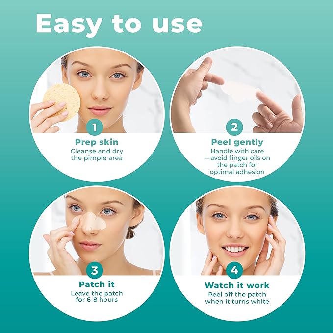 Pimple Patches for Nose (12 Pack), Cover Nose Pimples - Hydrocolloid Acne Patches - Pimple Patch Hydrocolloid Patches & Pimple Stickers, Nose Strip, Zit Patches
