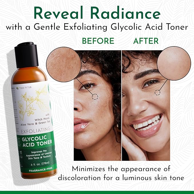 Tree To Tub Glycolic Acid Toner, Ginseng Green Tea Face Moisturizer Bundle – Gentle Daily Skincare with Witch Hazel, Hyaluronic Acid & Aloe for Dry, Sensitive, or Uneven-Looking Skin