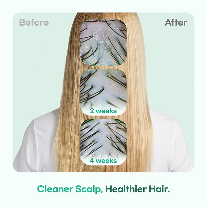 TS GD Shampoo for Flake Prone, Uncomfortable Scalp (14.1 Fl Oz) For Youth & Teens | Gentle Scalp-Care Routine | Silicone, SLS, SLES Free | Korean Hair Care (Green)