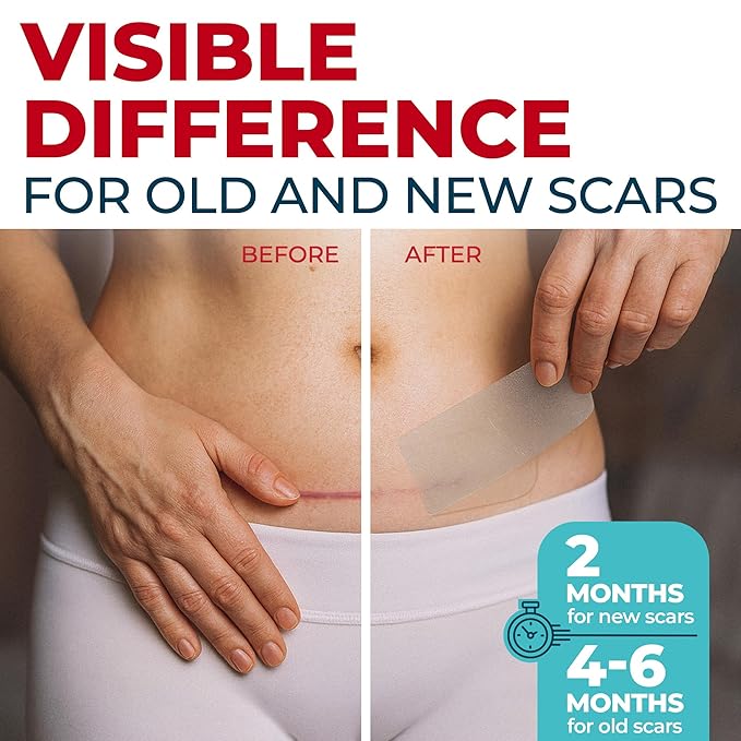 Medical Grade Silicone Scar Tape - Transparent (1.6”x150”) - Visible Difference on Surgical & Keloid Scars - Reusable Silicone Scar Sheets - Easy to Use Silicone Tape for Scars