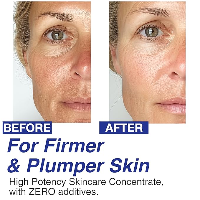 Volufiline 100% Concentrate Firming Serum for Sagging Skin – Face Tightening, Jawline & V-Line Contour Booster, Anti-Wrinkle Collagen Enhancer | Fast-Absorbing Mix-in Korean Skincare