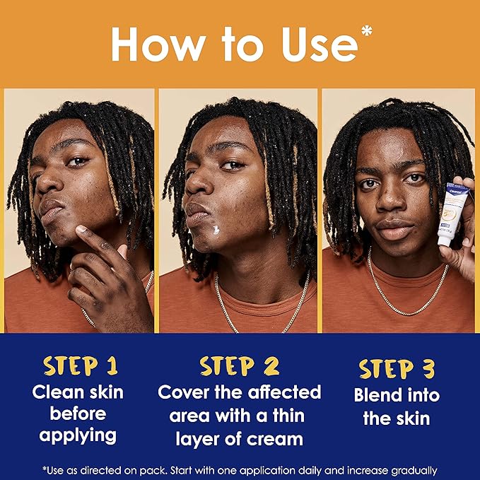 Clearasil Stubborn Acne Control 5in1 Spot Treatment Cream, Maximum Strenght with 10% Benzoyl Peroxide, Acne Medication, 1 oz
