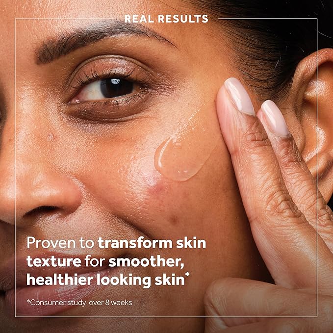 No7 Derm Solutions AHA Exfoliant & Face Toner with Lactic & Glycolic Acid - AHA Smoothing Treatment - Controls Oil and Minimizes Pores - for Oily & Blemish-Prone Skin (1 Fl Oz)