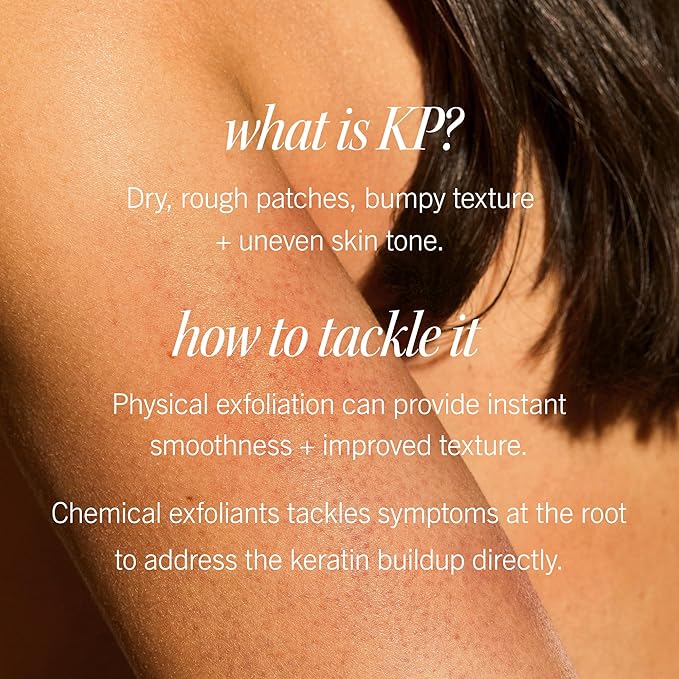 First Aid Beauty - KP Bump Eraser Body Scrub with 10% AHA, Keratosis Pilaris Exfoliator with Glycolic and Lactic acids, Helps Reduce Chicken Skin Bumps, Safe for Sensitive Skin, Strawberry Scent, 8 oz