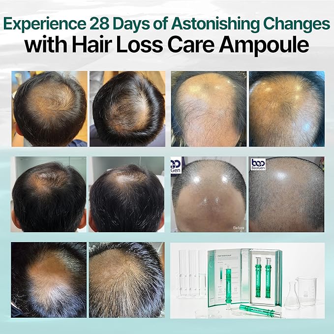BAO_H.LAB Hair Loss Care Ampoule for Hair Thinning & Shedding, Healthier Scalp & Thicker Fuller Looking Hair in One Month Hair Care Solution, Non-oily Non-greasy 2 Ampoules in One Pack Korean Haircare