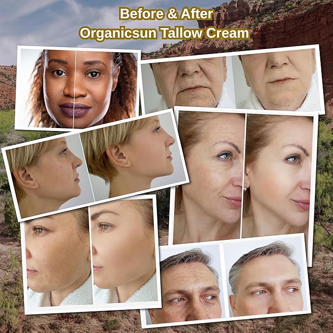 Beef Tallow Face Cream - 100% Grass Fed Anti Aging Moisturizer with Copper Peptides, Honey & Collagen for Wrinkles & Firming