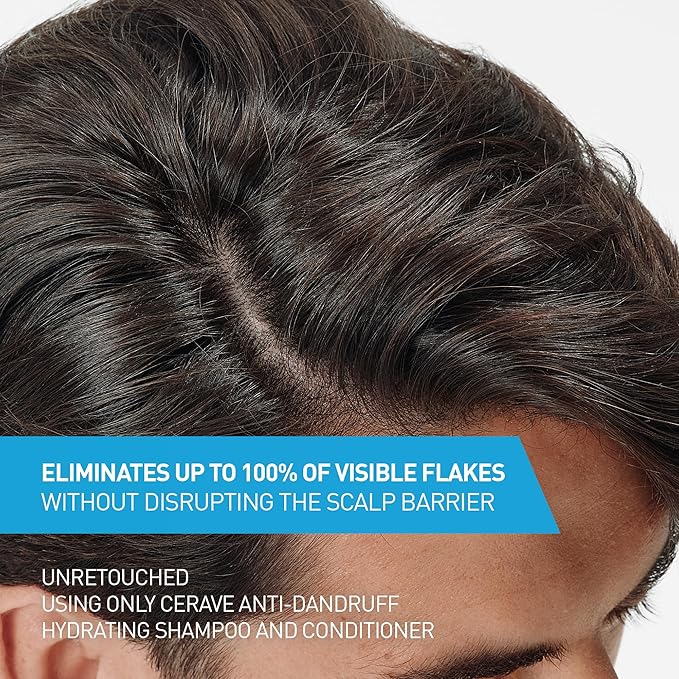 CeraVe Hydrating Anti Dandruff Conditioner, 0.5% Pyrithione Zinc Dandruff Treatment With Ceramides, Hyaluronic Acid & Niacinamide, Helps Eliminate Flakes & Reduce Itchy Scalp, Sulfate Free Conditioner | Hydrating