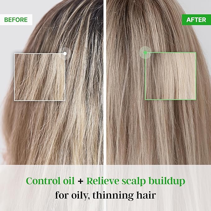 All New Plus TS Shampoo with Biotin for Hair Loss Prevention | Therapy Shampoo for Damaged Hair | Korea Hair Care for Men & Women (16.9 Fl Oz)